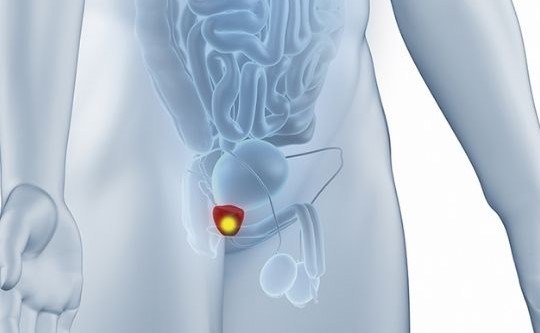 Hiperplasia Prostática Benigna - Dr. Bruno Passos